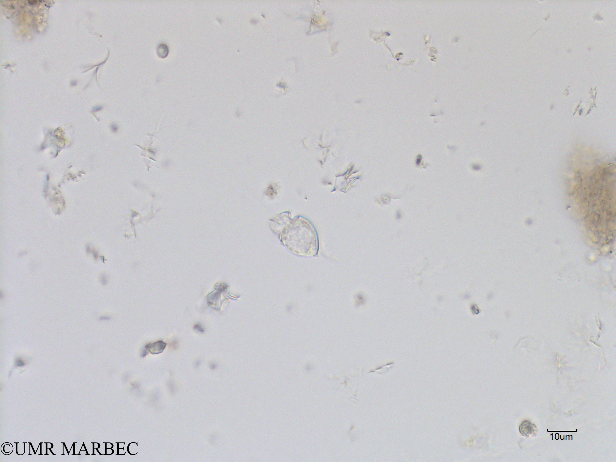 phyto/Bizerte/bizerte_bay/RISCO July 2016/Oxytoxum laticeps (Baie_T1A-cf corythodinium-7).tif(copy).jpg